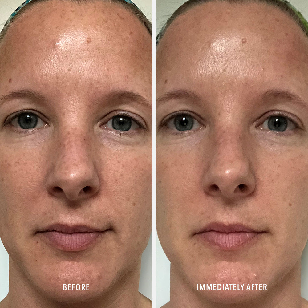 Polish & Plump Face Peel