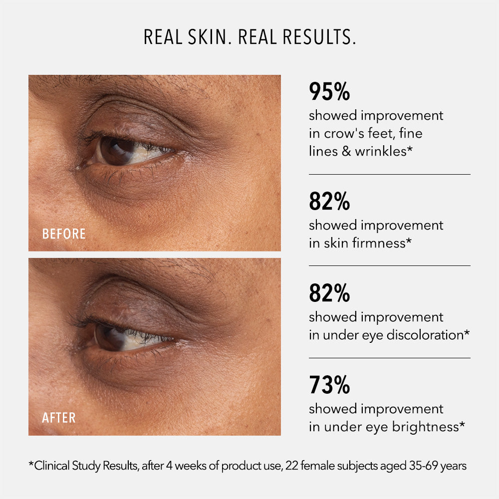 Retinol Eye Renewal