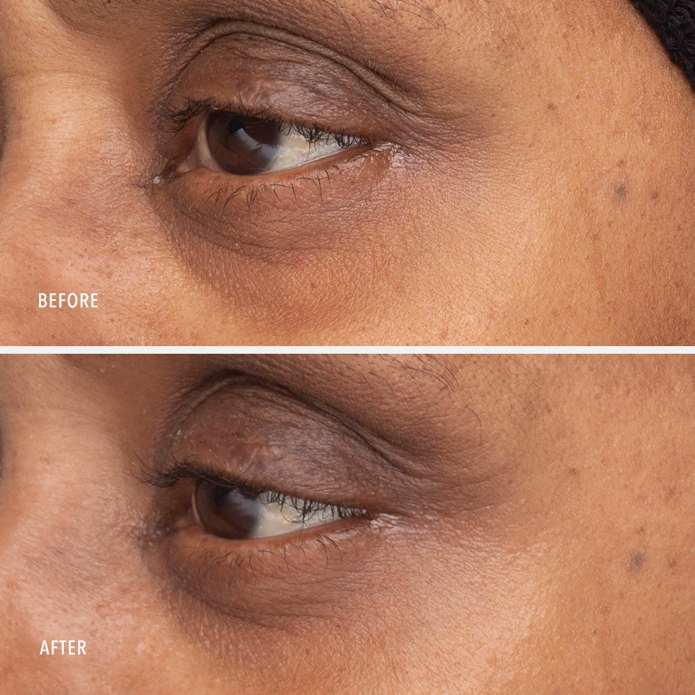 Retinol Eye Renewal