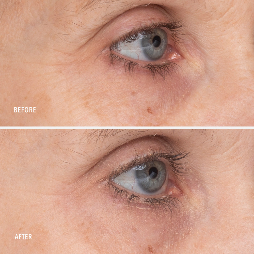 Retinol Eye Renewal