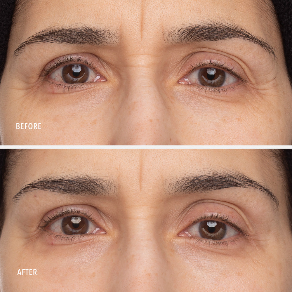 Retinol Eye Renewal