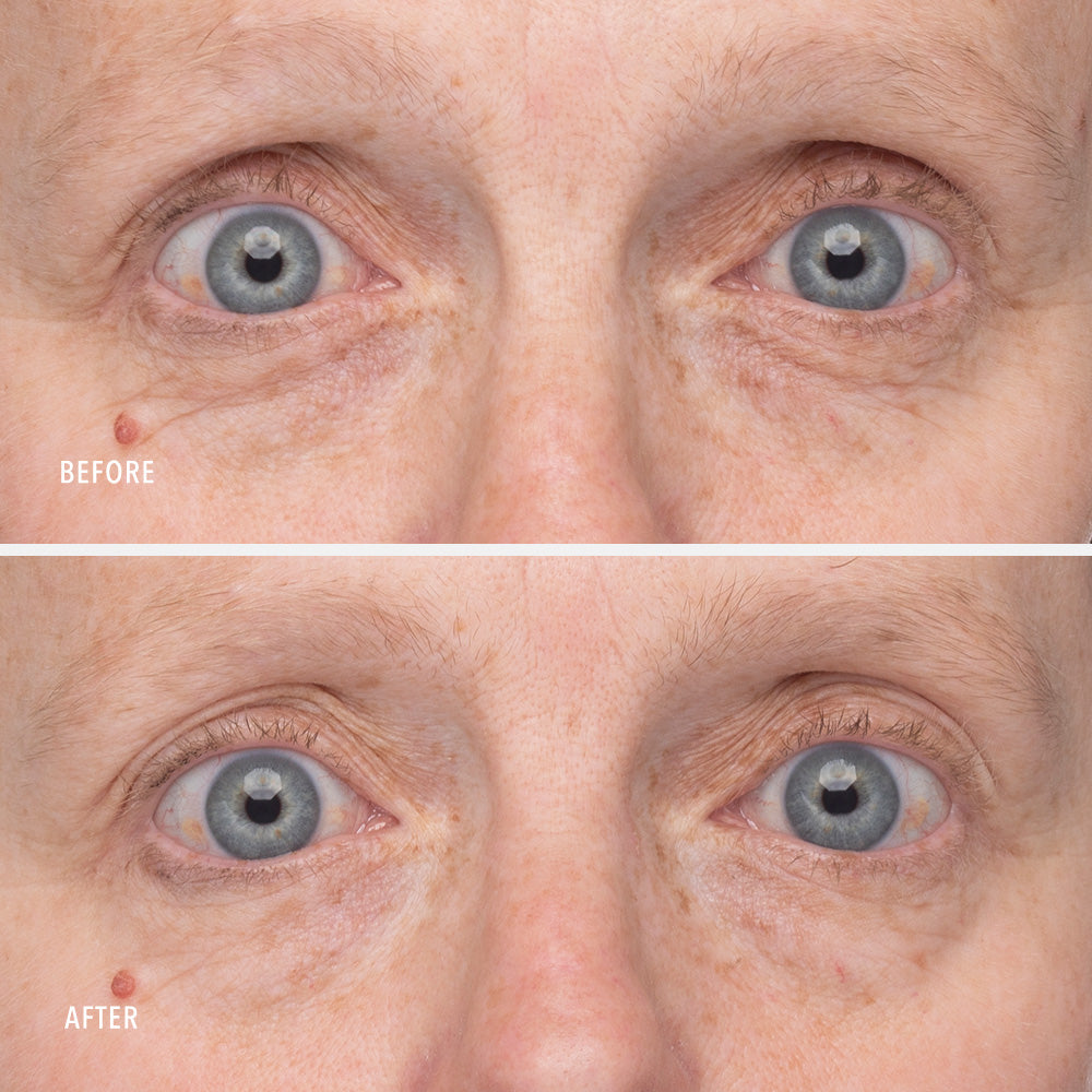 Retinol Eye Renewal